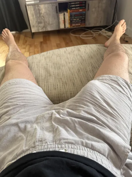 20 Straight bulging in shorts